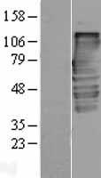 Alpha Taxilin (TXLNA) Human Over-expression Lysate