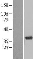 ZADH2 Human Over-expression Lysate