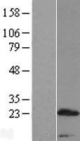 PRR15 Human Over-expression Lysate