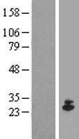 IFNE1 (IFNE) Human Over-expression Lysate