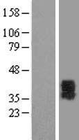 P2Y6 (P2RY6) Human Over-expression Lysate
