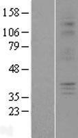 P2Y6 (P2RY6) Human Over-expression Lysate