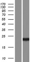 p21 Ras (HRAS) Human Over-expression Lysate