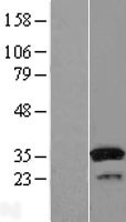 SULT1A1 Human Over-expression Lysate