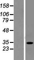SULT1A2 Human Over-expression Lysate