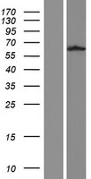 TUB Human Over-expression Lysate