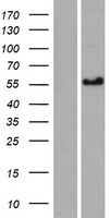CCDC125 Human Over-expression Lysate