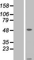 ATPase Inhibitory Factor 1 (ATPIF1) Human Over-expression Lysate