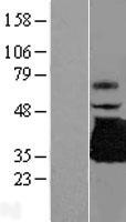 TREML1 Human Over-expression Lysate