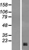 GPIHBP1 Human Over-expression Lysate