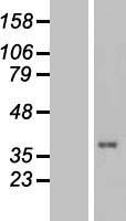 TUSC3 Human Over-expression Lysate