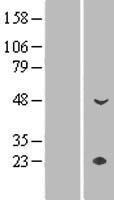 CYP4Z1 Human Over-expression Lysate