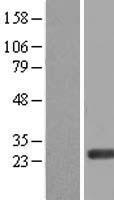 ERAS Human Over-expression Lysate