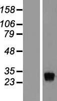 EXOSC8 Human Over-expression Lysate