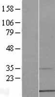 CMC1 Human Over-expression Lysate