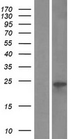 VMO1 Human Over-expression Lysate