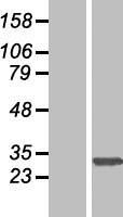 SLC35E2A Human Over-expression Lysate