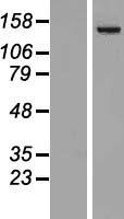 Phospholipase C beta 4 (PLCB4) Human Over-expression Lysate