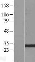 GSTO2 Human Over-expression Lysate