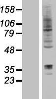 DORFIN (RNF19A) Human Over-expression Lysate