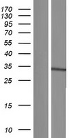 UBE2J2 Human Over-expression Lysate