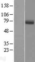 EYS Human Over-expression Lysate
