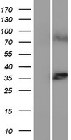 Ceramide synthase 1 (CERS1) Human Over-expression Lysate