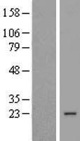 COPS8 Human Over-expression Lysate