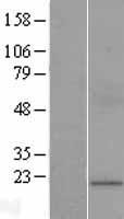 GJB7 Human Over-expression Lysate
