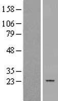 PTGES2 Human Over-expression Lysate