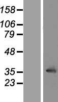 LRRC10 Human Over-expression Lysate