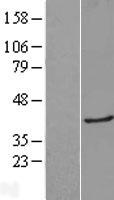 Galectin 8 (LGALS8) Human Over-expression Lysate