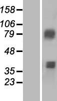 ACSM3 Human Over-expression Lysate