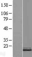 Stathmin 1 (STMN1) Human Over-expression Lysate