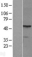 PRAME Human Over-expression Lysate