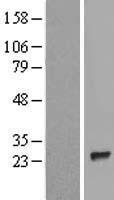 TP73-AS1 Human Over-expression Lysate