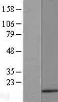 Keratinocyte differentiation associated protein (KRTDAP) Human Over-expression Lysate
