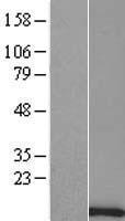 TTTY8 Human Over-expression Lysate