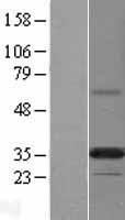 PLPP6 Human Over-expression Lysate