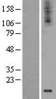 GDNF Human Over-expression Lysate