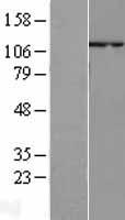 p107 (RBL1) Human Over-expression Lysate
