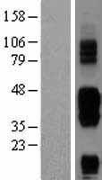 CD272 (BTLA) Human Over-expression Lysate