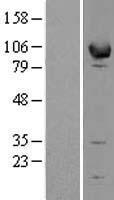 EPB41L1 Human Over-expression Lysate