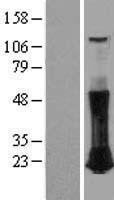 RHOC Human Over-expression Lysate