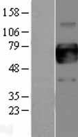 GM CSF Receptor alpha (CSF2RA) Human Over-expression Lysate