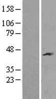 IL12RB1 Human Over-expression Lysate