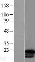 HOXC6 Human Over-expression Lysate