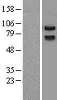 Prickle (PRICKLE1) Human Over-expression Lysate