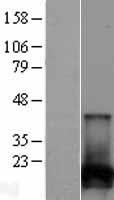 NUDT2 Human Over-expression Lysate