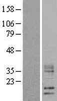 WFDC5 Human Over-expression Lysate